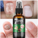 Belleza 7 Days Nails Ecuador – Trata los Hongos y Recupera tus Uñas en una Semana de Tendeli- Ecuador en